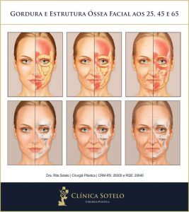 ritidoplastia envelhecimento da face